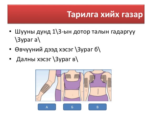 Арьсан доторх тарилга
