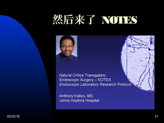 02/02/18 21
然后来了 NOTES
 