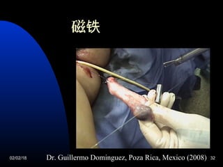 02/02/18 32Dr. Guillermo Dominguez, Poza Rica, Mexico (2008)
磁铁
 