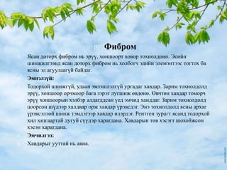  Фибром
 Ясан доторх фибром нь эрүү, хоншоорт ховор тохиолдоно. Эсийн
шинжилгээнд ясан доторх фибром нь холбогч эдийн элемэнтээс тогтох ба
ясны эд агуулаагүй байдаг.
 Эмнэлзүй:
 Тодорхой шинжгүй, удаан эмзэшлэлгүй ургадаг хавдар. Зарим тохиолдолд
эрүү, хоншоор орчмоор бага зэрэг лугшиж өвдөнө. Өвчтөн хавдар томорч
эрүү хоншоорын хэлбэр алдагддсан үед эмчид ханддаг. Зарим тохиолдолд
цоорсон шүдээр халдвар орж хавдар үрэвсдэг. Энэ тохиолдолд ясны архаг
үрэвсэлтөй шинж тэмдэгээр хавдар илэрдэг. Рентген зурагт ясанд тодорхой
хил хязгаартай дугуй сүүдэр харагдана. Хавдарын төв хэсэгт шохойжсон
хэсэн харагдана.
 Эмчилгээ:
 Хавдарыг ууттай нь авна.
 