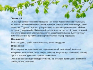  Эмнэл зүй:
 Эмнэл зүй шинж тэмдэггүй явагдана. Гол төлөв хоншоор ясанд тохиолдох
ба тагнай, шанаа орчмоор яс овойж зузаарах шинж илэрч эмзэглэлгүй, удаан
томордог. Түүшин сэртэнгээр тархсанаар шүд аажмаар хөдөлгөөнтэй болж
түүшин зузаарч овойн. Фиброзный дисплази нь эмзэглэлгүй удаан ургалттай
тул хэдэн арван жил үргэлжилж өвчтөн анзаардаггүй байна. Рентген зураг
гэмтсэн хэсгийн яс тархмал зузаарч нягтарсан сүүдэр харагдана.
 Оношлогоо:
 Рентген зураг , эдийн шинжилгээгээр онош тодруулна.
 Ялгах онош:
 Остеосарком, остеом, хондром, периапикальный цементный дисплази.
 Фибрознй дисплазийн салст саарал өнгөтэй, амархан цус гарамтгай, хутгаар
зүсэхэд зөөлөн, ууссан сахар шиг шажигнана.
 Эсийн шинжилгээнд боловсроогүй ясны эд агуулсан ясны эдийн ширхэглэг
эсийн ургалт харагдана.
 