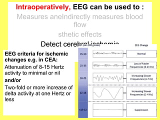 Advances in neuro anesthesia monitoring | PPT