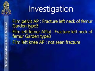 Film pelvis AP : Fracture left neck of femur
Garden type3
Film left femur AP,lat : Fracture left neck of
femur Garden type3
Film left knee AP : not seen fracture
Investigation
PhramongkutklaoCollegeofMedicine
 
