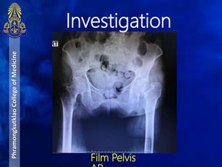 PhramongkutklaoCollegeofMedicine
Film Pelvis
Investigation
 