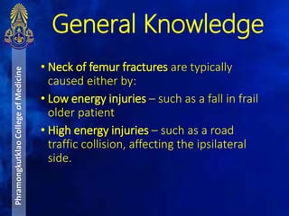 General Knowledge
• Neck of femur fractures are typically
caused either by:
• Low energy injuries – such as a fall in frail
older patient
• High energy injuries – such as a road
traffic collision, affecting the ipsilateral
side.
PhramongkutklaoCollegeofMedicine
 