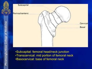 PhramongkutklaoCollegeofMedicine
•Subcapital: femoral head/neck junction
•Transcervical: mid portion of femoral neck
•Basocervical: base of femoral neck
 