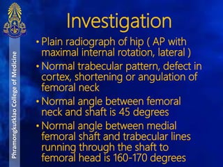 • Plain radiograph of hip ( AP with
maximal internal rotation, lateral )
• Normal trabecular pattern, defect in
cortex, shortening or angulation of
femoral neck
• Normal angle between femoral
neck and shaft is 45 degrees
• Normal angle between medial
femoral shaft and trabecular lines
running through the shaft to
femoral head is 160-170 degrees
Investigation
PhramongkutklaoCollegeofMedicine
 
