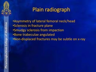 Plain radiograph
PhramongkutklaoCollegeofMedicine
•Asymmetry of lateral femoral neck/head
•Sclerosis in fracture plane
•Smudgy sclerosis from impaction
•Bone trabeculae angulated
•Non-displaced fractures may be subtle on x-ray
 