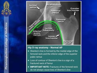 PhramongkutklaoCollegeofMedicine
 