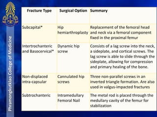 ManagementPhramongkutklaoCollegeofMedicine Fracture Type Surgical Option Summary
Subcapital* Hip
hemiarthroplasty
Replacement of the femoral head
and neck via a femoral component
fixed in the proximal femur
Intertrochanteric
and Basocervical*
Dynamic hip
screw
Consists of a lag screw into the neck,
a sideplate, and cortical screws. The
lag screw is able to slide through the
sideplate, allowing for compression
and primary healing of the bone.
Non-displaced
intra-capsular
Cannulated hip
screws
Three non-parallel screws in an
inverted triangle formation. Are also
used in valgus-impacted fractures
Subtrochanteric Intramedullary
Femoral Nail
The metal rod is placed through the
medullary cavity of the femur for
stabilization
 