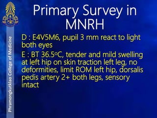 D : E4V5M6, pupil 3 mm react to light
both eyes
E : BT 36.5oC, tender and mild swelling
at left hip on skin traction left leg, no
deformities, limit ROM left hip, dorsalis
pedis artery 2+ both legs, sensory
intact
Primary Survey in
MNRH
PhramongkutklaoCollegeofMedicine
 