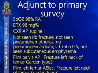 SpO2 98% RA
DTX 98 mg%
CXR AP supine :
Not seen rib fracture, not seen
pneumohemothorax, no
pneumopericardium, CT ratio 0.5, not
seen subcutaneous emphysema
Film pelvis AP : Fracture left neck of
femur Garden type3
Film left femur AP,lat : Fracture left neck
Adjunct to primary
survey
PhramongkutklaoCollegeofMedicine
 