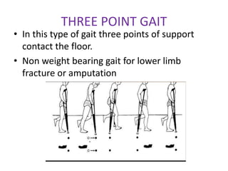 Spinal orthotics and walking aids | PPTX