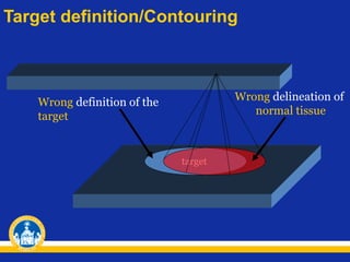 Target definition/Contouring

Wrong delineation of
normal tissue

Wrong definition of the
target

target

 