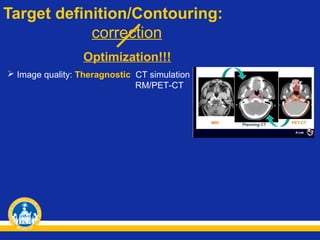 Target definition/Contouring:
correction
Optimization!!!
 Image quality: Theragnostic CT simulation
RM/PET-CT

 