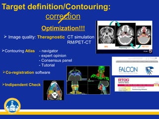Target definition/Contouring:
correction
Optimization!!!
 Image quality: Theragnostic CT simulation
RM/PET-CT
Contouring Atlas

- navigator
- expert opinion
- Consensus panel
- Tutorial

Co-registration software
Indipendent Check

 