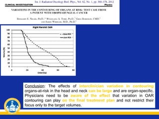 Conclusion: The effects of interclinician variation in contouring
organs-at-risk in the head and neck can be large and are organ-specific.
Physicians need to be aware of the effect that variation in OAR
contouring can play on the final treatment plan and not restrict their
focus only to the target volumes.

 