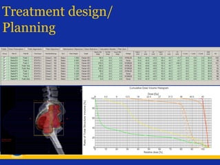 Treatment design/
Planning

 