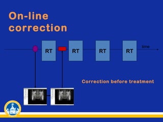On-line
correction
RT

RT

RT

RT

time

Correction before treatment

 