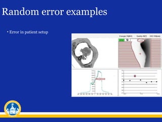 Random error examples
• Error in patient setup

 