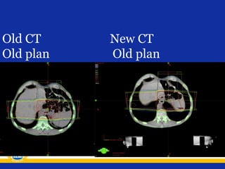 Old CT
Old plan

New CT
Old plan

 