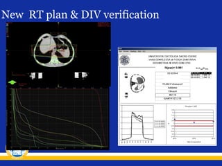 New RT plan & DIV verification

 