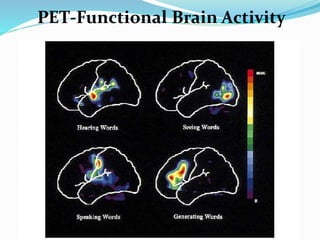 PET-Functional Brain Activity
 