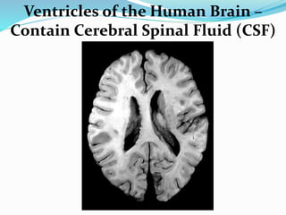 Ventricles of the Human Brain –
Contain Cerebral Spinal Fluid (CSF)
 