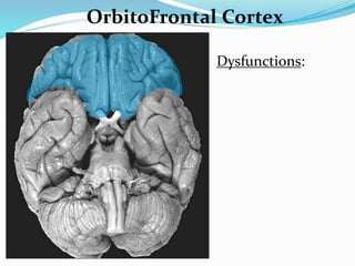 OrbitoFrontal Cortex
Dysfunctions:
 