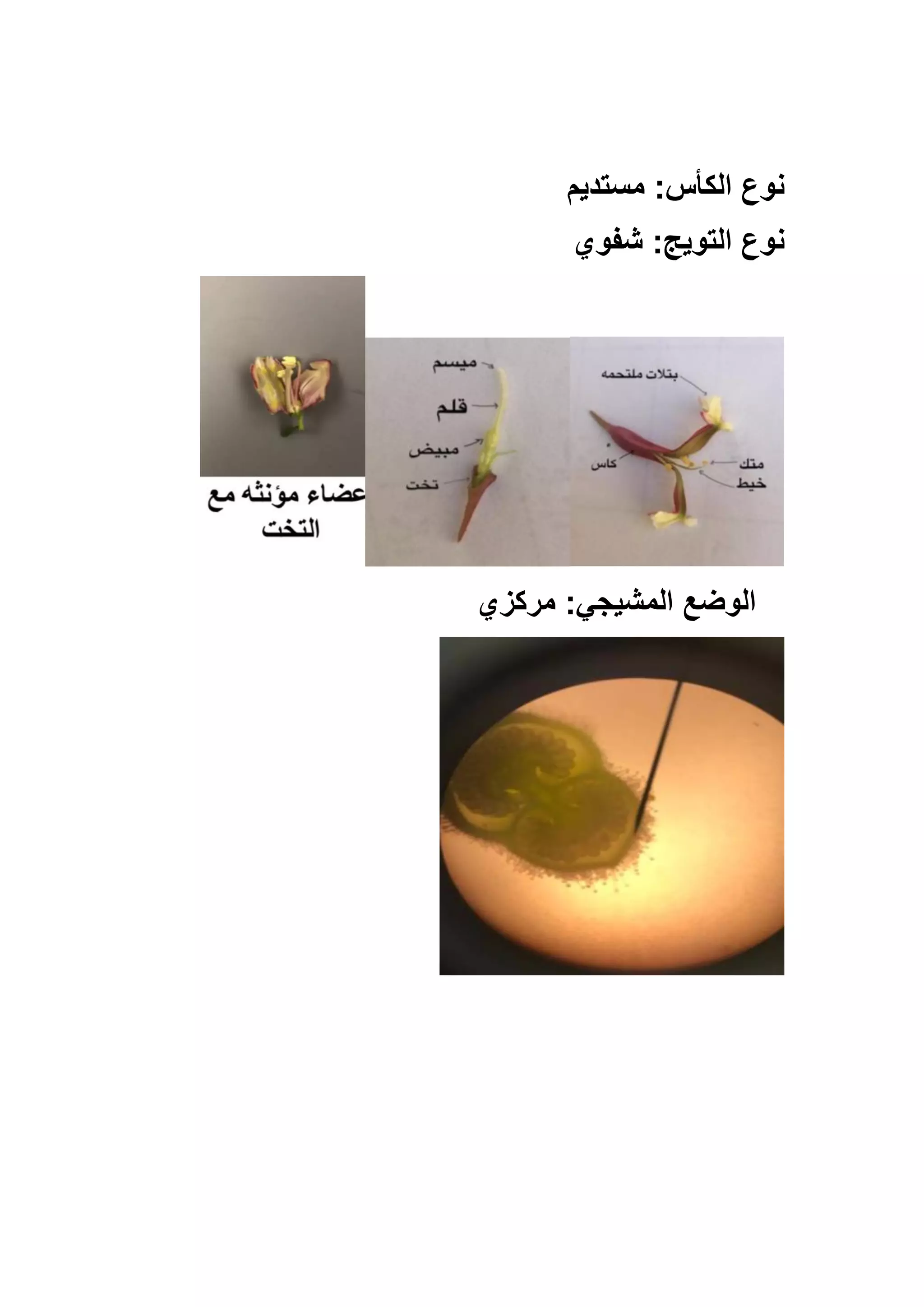 ‫مستديم‬ :‫الكأس‬ ‫نوع‬
‫شفوي‬ :‫التويج‬ ‫نوع‬
‫مركزي‬ :‫المشيجي‬ ‫الوضع‬
 