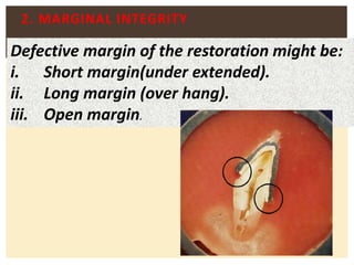 Marginal Opening Basic Principles of crowns & bridges | PPTX