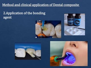 Method and clinical application of Dental composite
2.Application of the bonding
agent
 