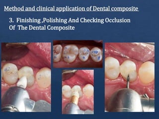 Method and clinical application of Dental composite
3. Finishing ,Polishing And Checking Occlusion
Of The Dental Composite
 