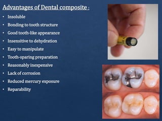 Advantages of Dental composite :
• Insoluble
• Bonding to tooth structure
• Good tooth-like appearance
• Insensitive to dehydration
• Easy to manipulate
• Tooth-sparing preparation
• Reasonably inexpensive
• Lack of corrosion
• Reduced mercury exposure
• Reparability
 