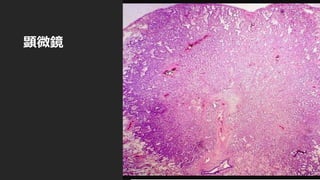 顕微鏡
 