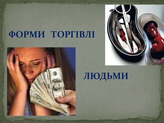 ФОРМИ ТОРГІВЛІ
ЛЮДЬМИ
 