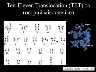 Ten-Eleven Translocation (TET) та
гострий мієлолейкоз
 