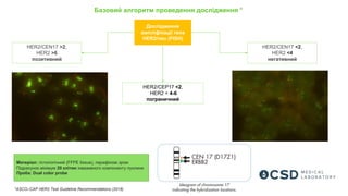 Матеріал: гістологічний (FFPE tissue), парафінові зрізи
Підрахунок мінімум 20 клітин інвазивного компоненту пухлини
Проба: Dual color probe
Дослідження
ампліфікації гена
HER2/neu (FISH)
Базовий алгоритм проведення дослідження *
HER2/CEN17 >2,
HER2 >6
позитивний
HER2/CEP17 <2,
HER2 = 4-6
пограничний
HER2/CEN17 <2,
HER2 <4
негативний
*ASCO–CAP HER2 Test Guideline Recommendations (2018)
 