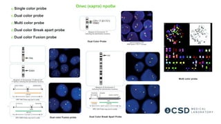 a) Single color probe
b) Dual color probe
c) Multi color probe
d) Dual color Break apart probe
e) Dual color Fusion probe
Dual Color Probe
Multi color probe
Dual color Fusion probe Dual Color Break Apart Probe
Опис (карта) проби
 
