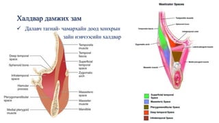Халдвар дамжих зам
✓ Далавч тагнай- чамархайн доод хонхрын
зайн нэвчээсийн халдвар
 