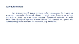Аденофлегмон
Энэ нэвчээс нь 3-7 насны хүүхдэд элбэг тохиолдоно. Эх үүсвэр нь
үрэвссэн тунгалгийн булчирхай бөгөөд түүний гадна бүрхүүл нь идээнд
идэгдсэнээс идээт үрэвсэл цааш mархаж булчирхай орчмын эслэгийг
хамарснаас булчирхай орчмын нэвчээс болно. Энэ процесс нь тунгалгийн
булчирхайн үрэвсэл эхэлснээс 2-4 дэх хоног дээр бий болно.
 
