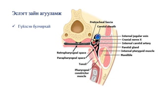 Эслэгт зайн агууламж
✓ Гүйлсэн булчирхай
 
