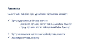 Ангилал
✓ Эрүү нүүр орчмын буглаа нэвчээс
- Хоншоор орчмын эслэгт зайн (Maxillary Spaces)
- Эрүү орчмын эслэгт зайн (Mandibular Spaces)
✓ Эрүү хоншоорын зэргэлдээх эдийн буглаа, нэвчээс
✓ Хавсарсан буглаа, нэвчээс
Эслэгт зайн байрлал зүй, үрэвслийн тархалтаас хамаарч
 
