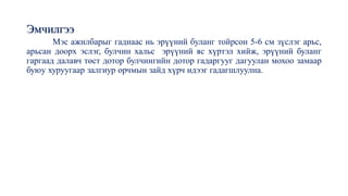 Эмчилгээ
Мэс ажилбарыг гаднаас нь эрүүний буланг тойрсон 5-6 см зүслэг арьс,
арьсан доорх эслэг, булчин хальс эрүүний яс хүртэл хийж, эрүүний буланг
гаргаад далавч төст дотор булчингийн дотор гадаргууг дагуулан мохоо замаар
буюу хуруугаар залгиур орчмын зайд хүрч идээг гадагшлуулна.
 