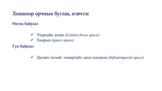 Хоншоор орчмын буглаа, нэвчээс
Өнгөц байрлал
✓ Ухархайн доорх (Canine fossa space)
✓ Хацрын (space space)
Гүн байрлал
✓ Далавч тагнай- чамархайн доод хонхрын (Infratemporal space)
 
