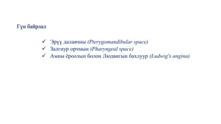 Гүн байрлал
✓ Эрүү далавчны (Pterygomandibular space)
✓ Залгиур орчмын (Pharyngeal space)
✓ Амны ёроолын болон Людвигын бахлуур (Ludwig's angina)
 