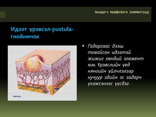 салстын өвчний шинж тэмдэг буюу элемент | PPT