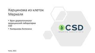 Карцинома из клеток
Меркеля
• Врач-дерматопатолог
медицинской лаборатории
CSD
• Калмыкова Антонина
Киев, 2021
 