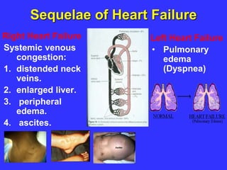 Cardiovascular | PPT