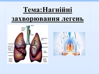 Тема:Нагнійні
захворювання легень
 